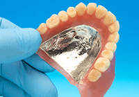 義歯の素材（金属床）