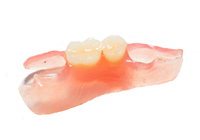 義歯の素材（ノンクラスプデンチャー）